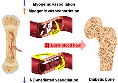 Vascular deficits contributing to skeletal fragility in type 1 diabetes